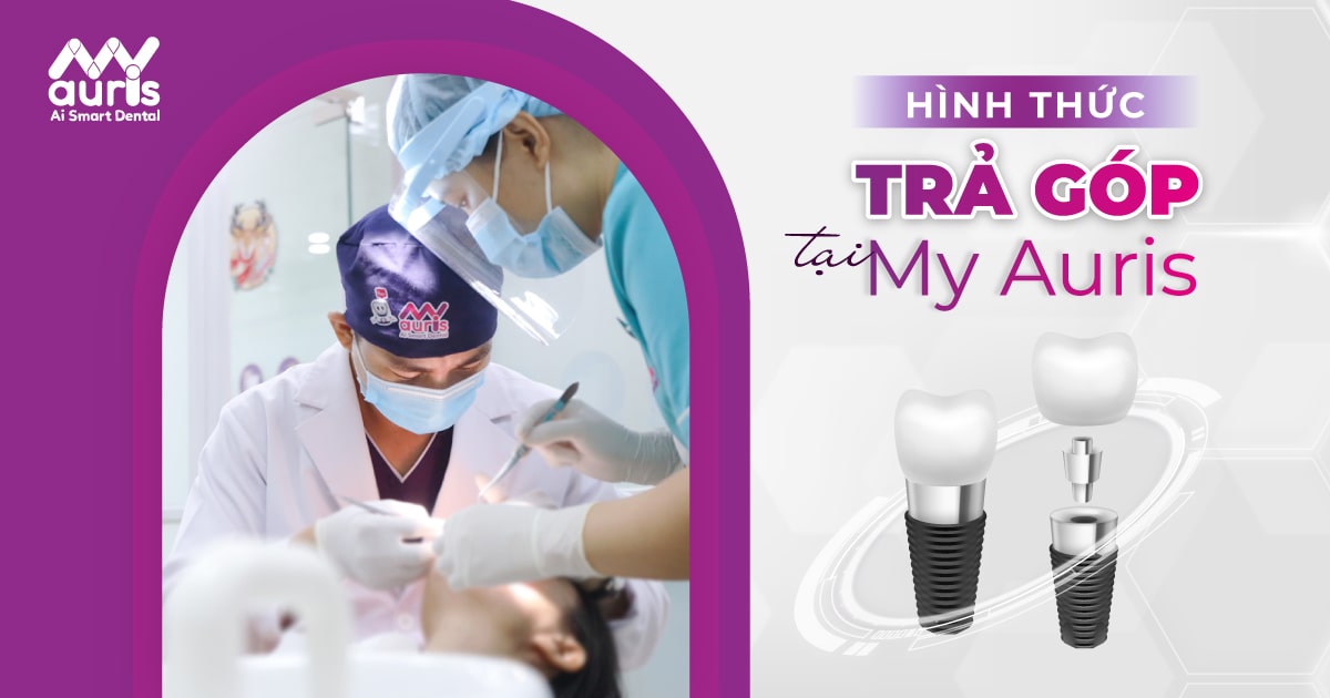 cắm implant trả góp