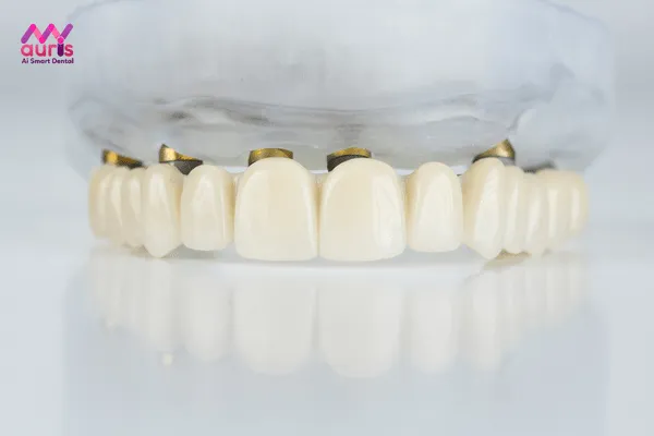 bọc răng sứ cho răng cửa bị mẻ