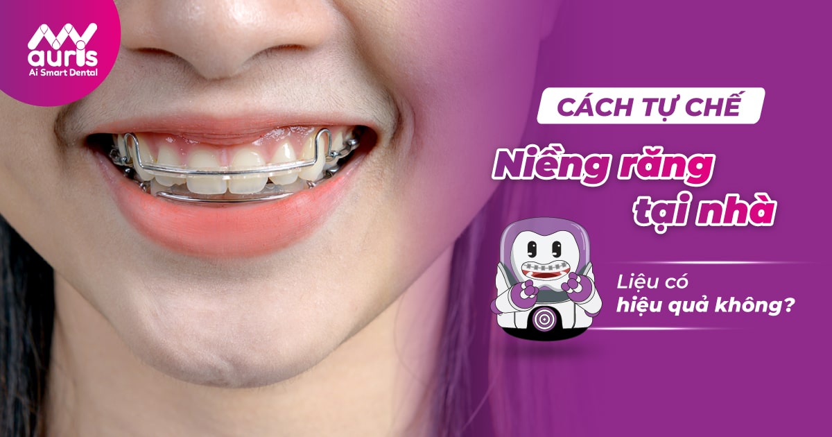 cách tự chế niềng răng tại nhà