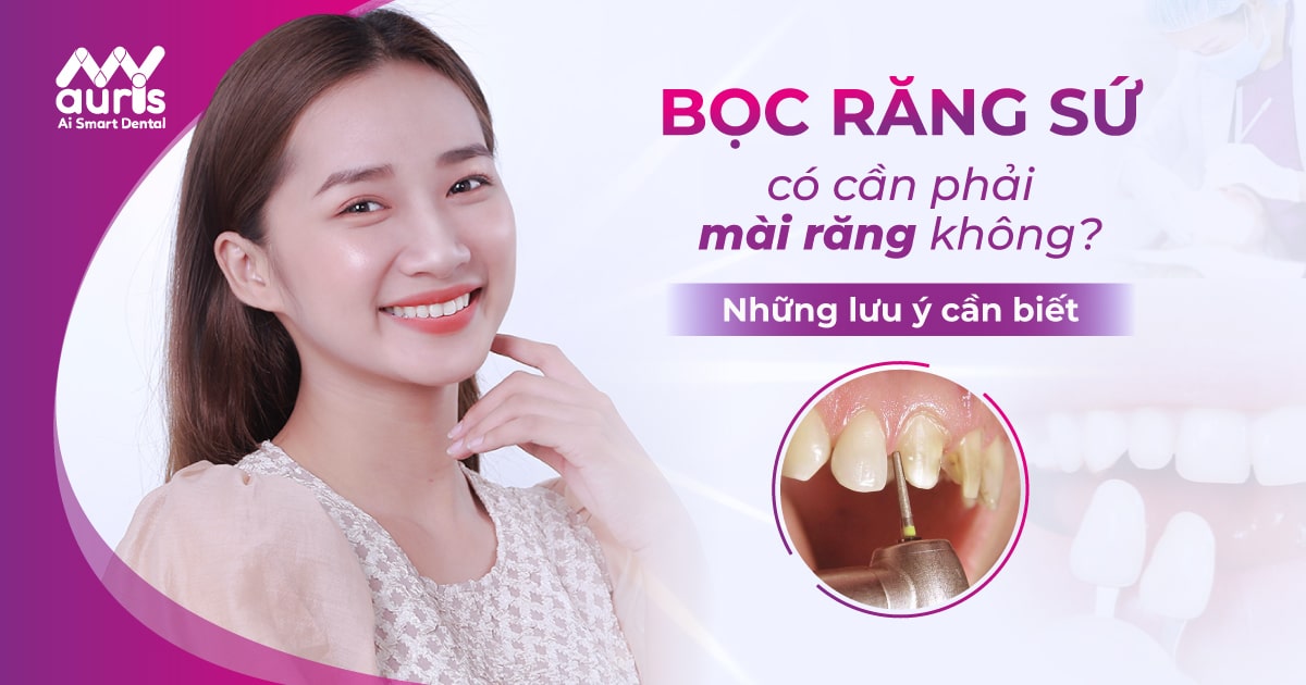 Hỏi đáp bọc răng sứ có cần phải mài răng không?