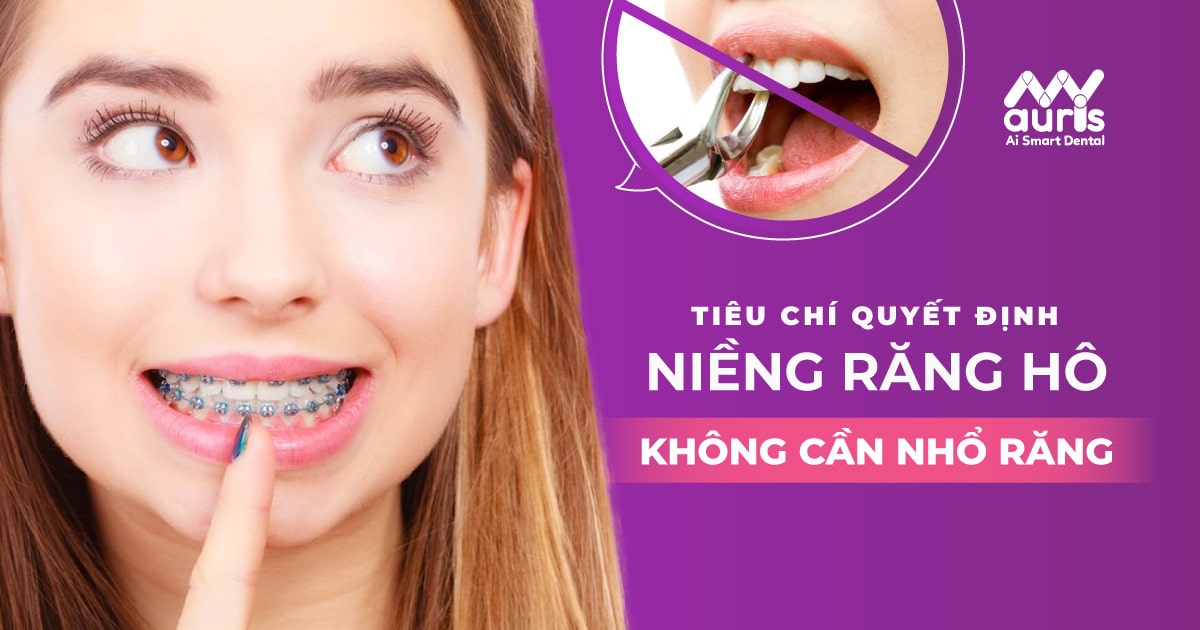 niềng răng hô không cần nhổ răng