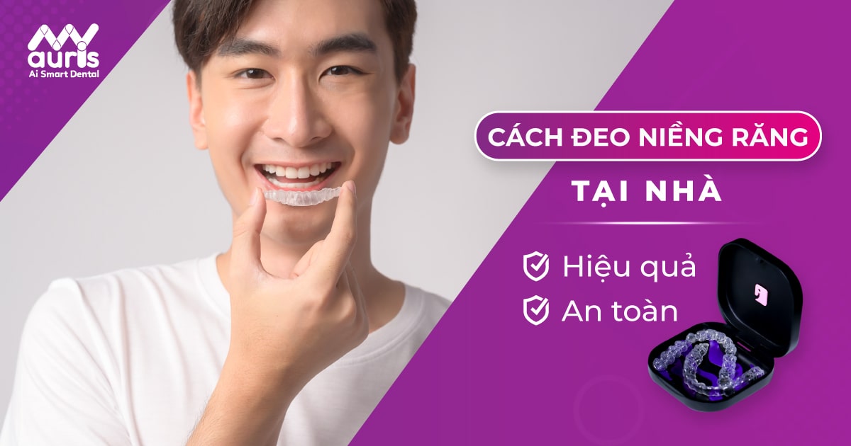 cách đeo niềng răng tại nhà