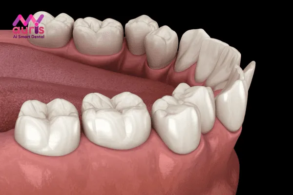 Sức khỏe có bị ảnh hưởng khi bạn có 36 cái răng?