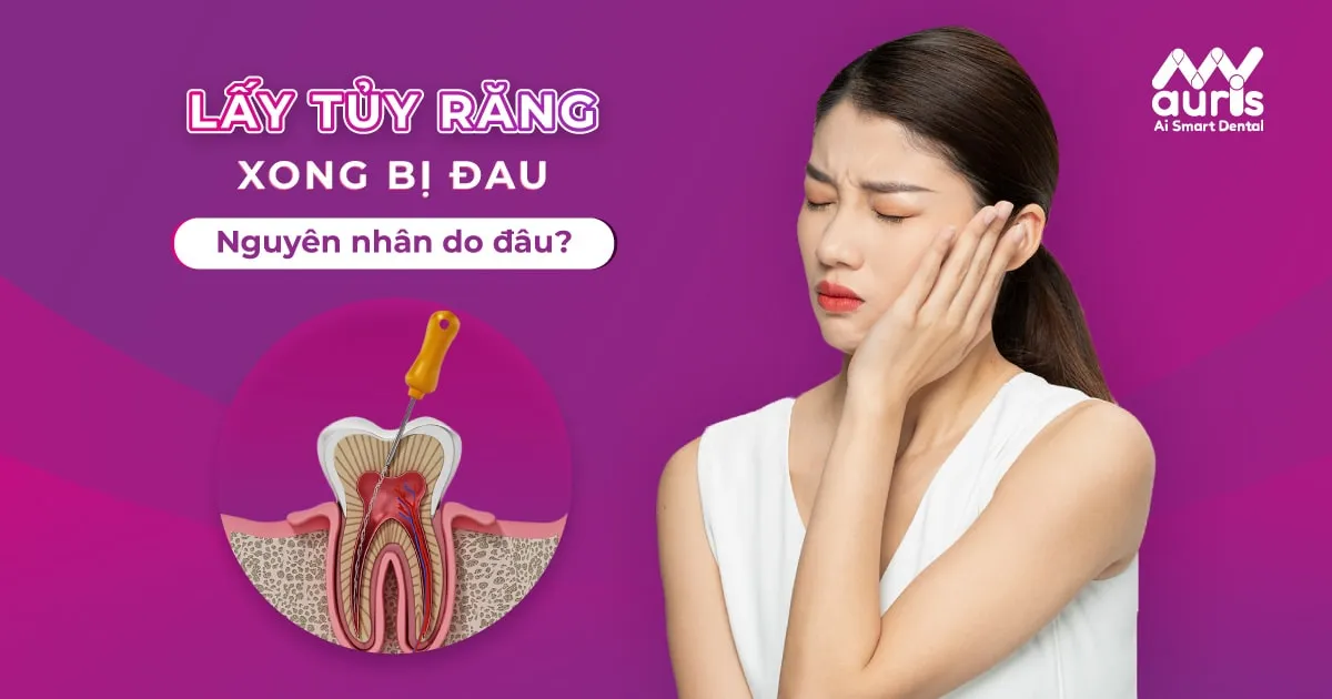Nguyên nhân gây ra việc lấy tủy răng xong bị đau?