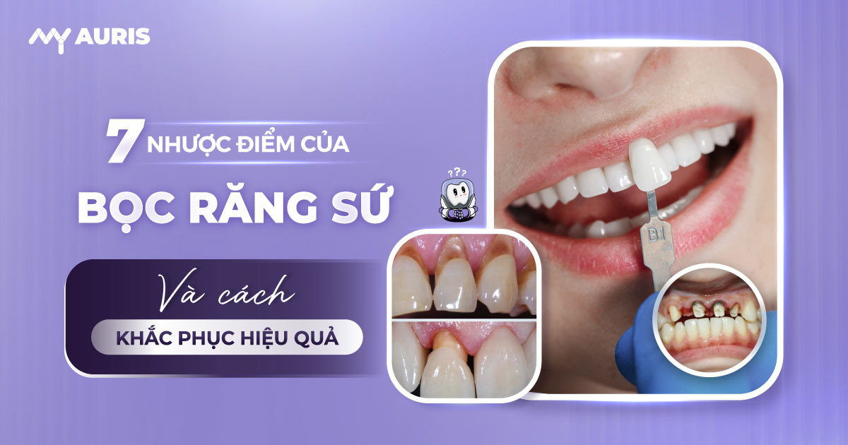 nhược điểm của việc bọc răng sứ