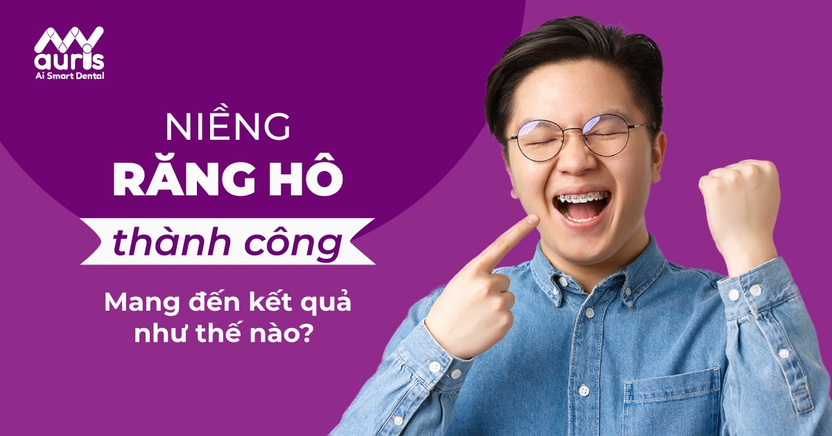 Niềng răng hô thành công như thế nào?