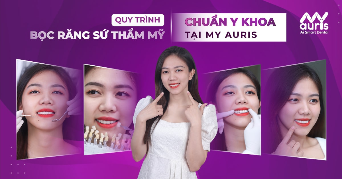 Quy trình bọc răng sứ thẩm mỹ an toàn và chuẩn y khoa