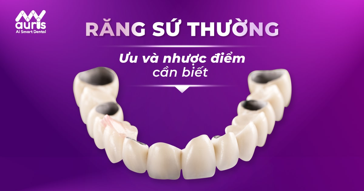 răng sứ thường