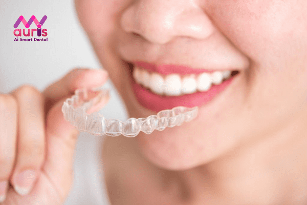 Invisalign là phương pháp gì?