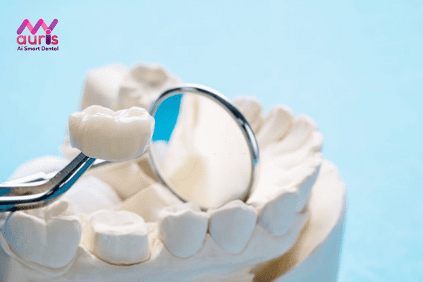 Dòng răng sứ không kim loại Cercon