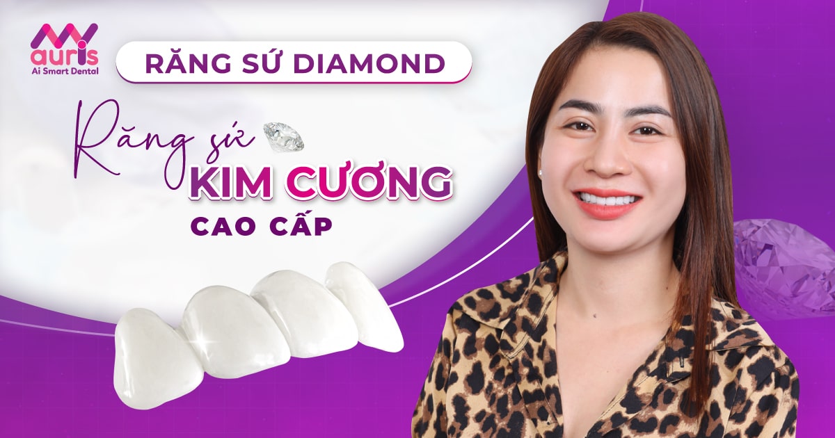 Tổng quan răng sứ Diamond những đặc điểm nổi bật