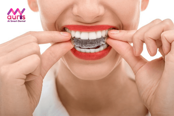 Khay niềng răng thường áp dụng cho người lớn
