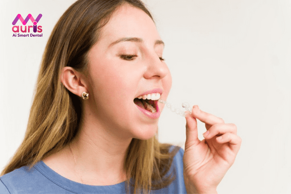 Lý do mà nhiều người sử dụng khuôn niềng răng tại nhà?