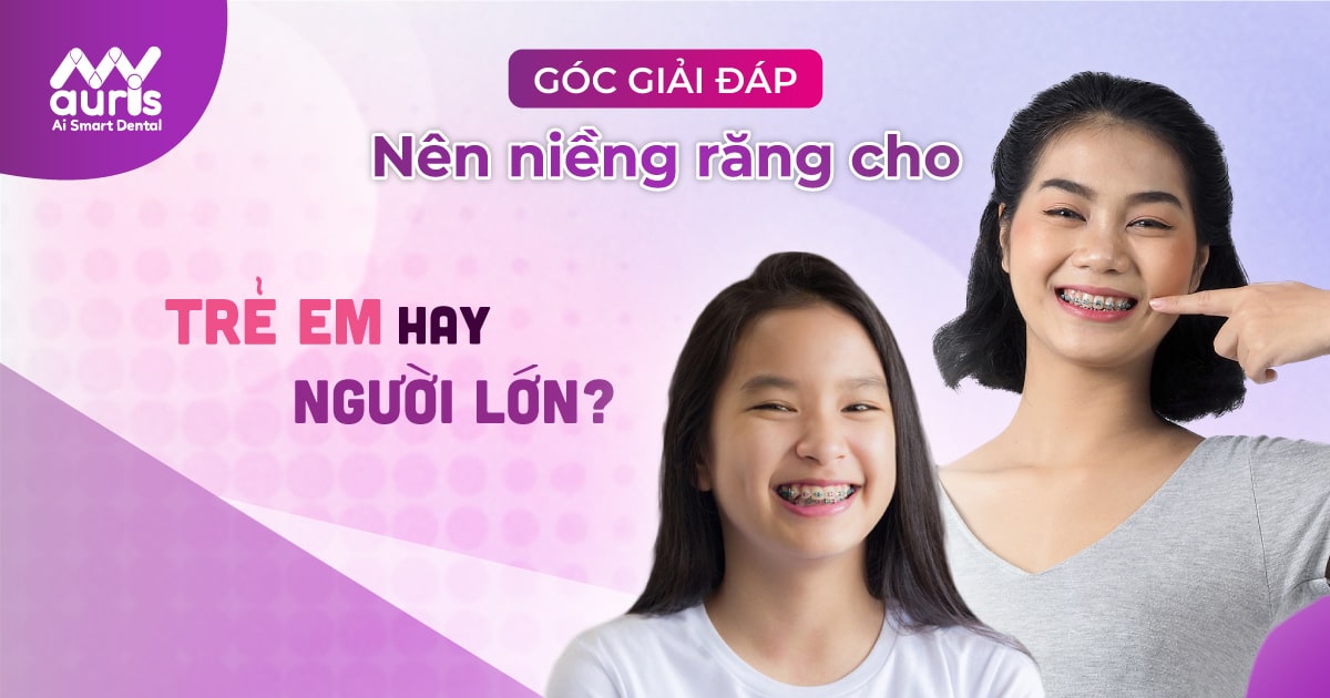 những trường hợp cần niềng răng