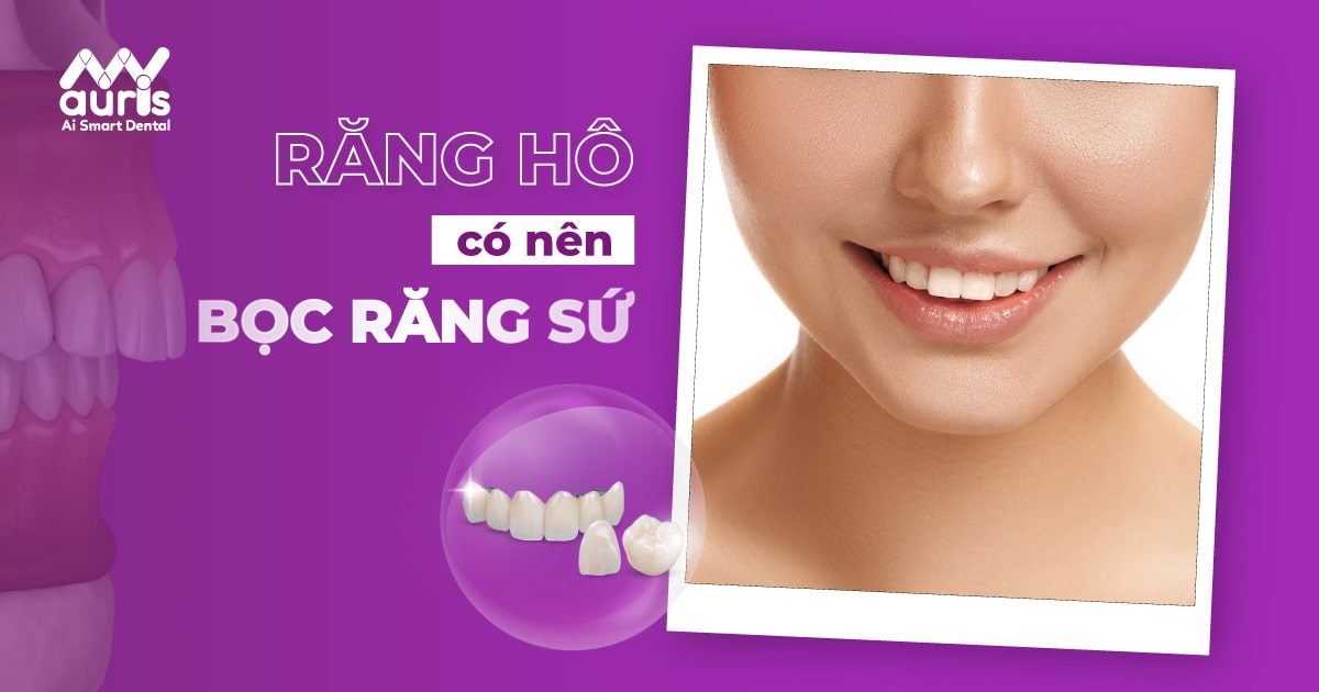 bọc răng sứ 2 răng cửa bị hô