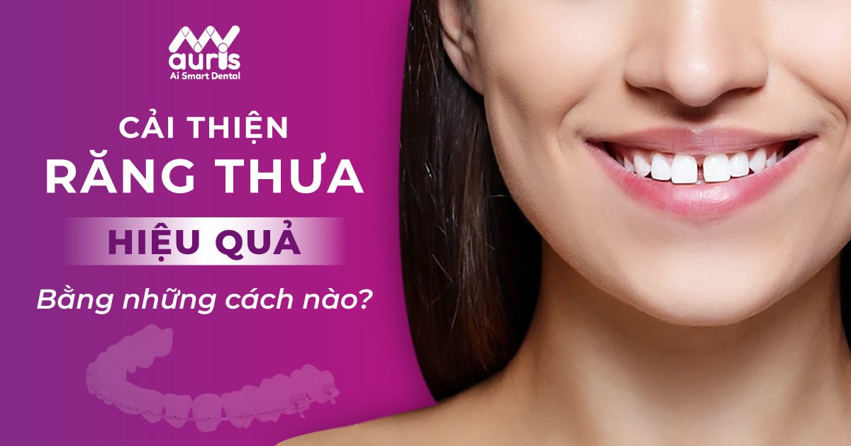 Cải thiện răng thưa bằng những cách nào hiệu quả?