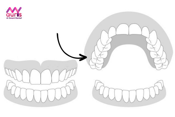 Vai trò của răng cấm trên cung hàm?