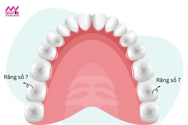 giá trồng răng số 7 hàm dưới bao nhiêu tiền
