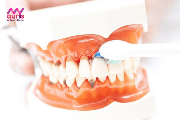 Sâu răng gây hôi miệng