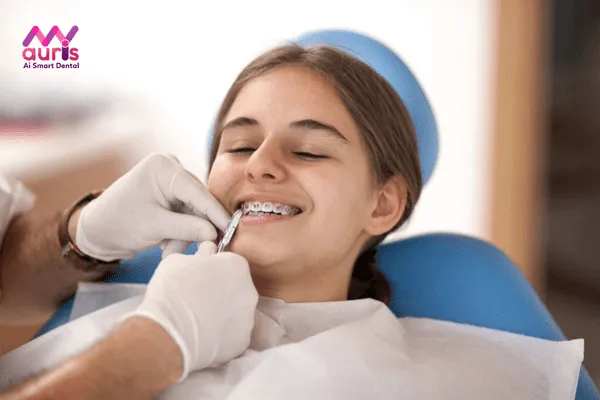 Kỹ thuật niềng răng mắc cài là gì?