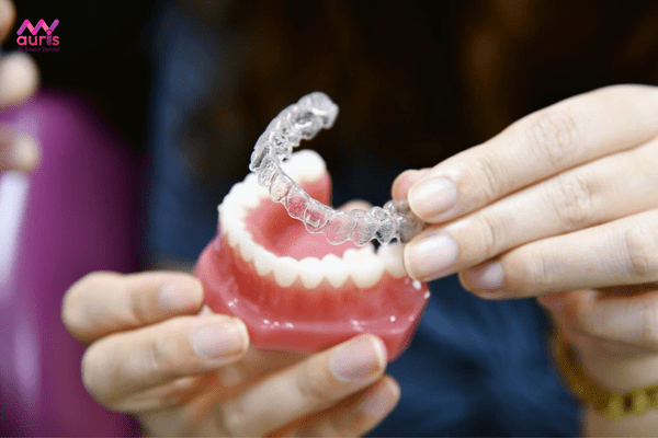 Có nên niềng răng invisalign hay không?