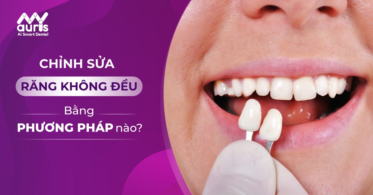 Phương pháp chỉnh sửa răng không đều nào an toàn và hiệu quả?