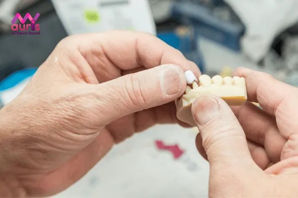 Các bước trong quá trình làm răng bọc sứ