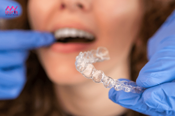 review niềng răng invisalign
