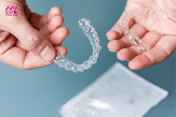 niềng răng invisalign review