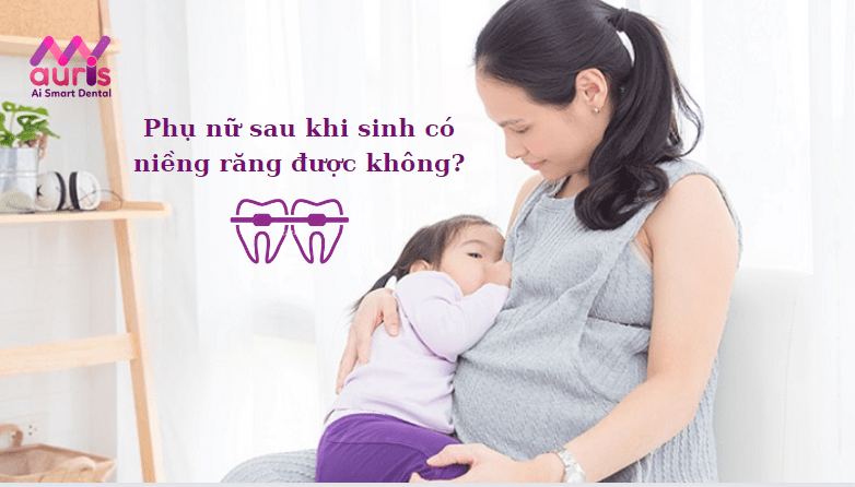 sau sinh bao lâu thì niềng răng được