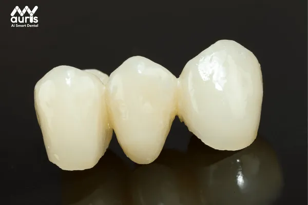so sánh răng sứ cercon và venus