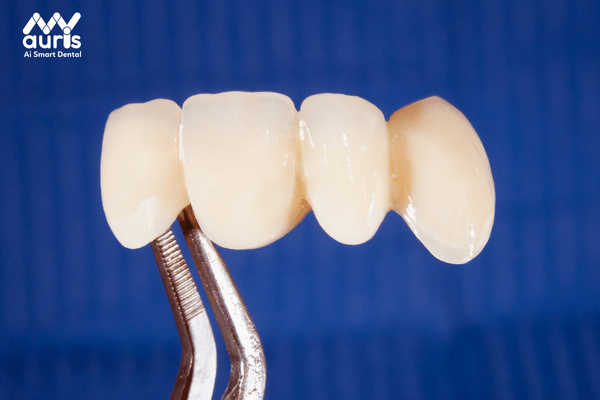 So sánh răng sứ cercon và zirconia 