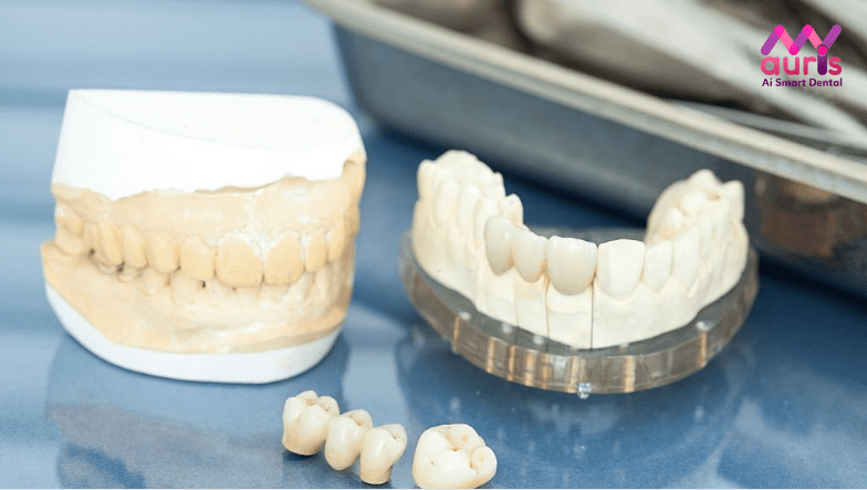 so sánh răng sứ kim loại và răng sứ titan