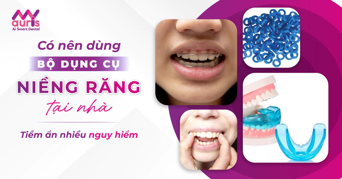 có nên dùng bộ dụng cụ niềng răng tại nhà