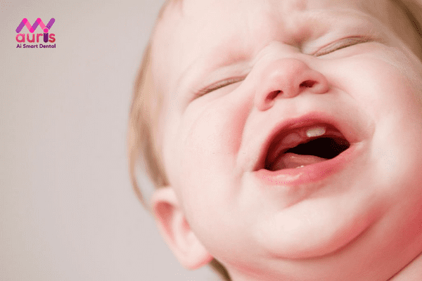 Tìm hiểu trẻ mấy tháng mọc răng?
