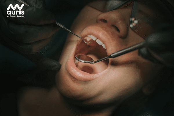 Trồng răng khểnh là phương pháp gì?