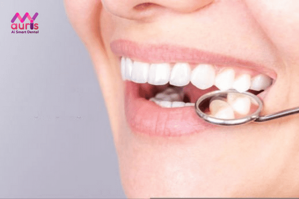 Giúp cố định răng trên cung hàm