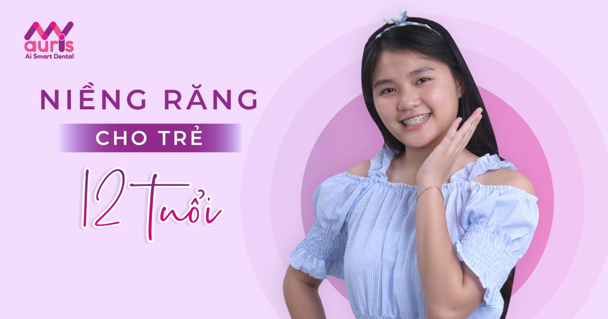 giá niềng răng cho trẻ 12 tuổi