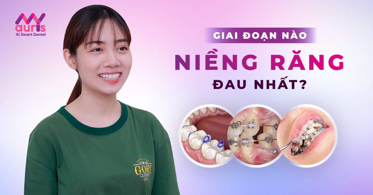 đi niềng răng có đau không