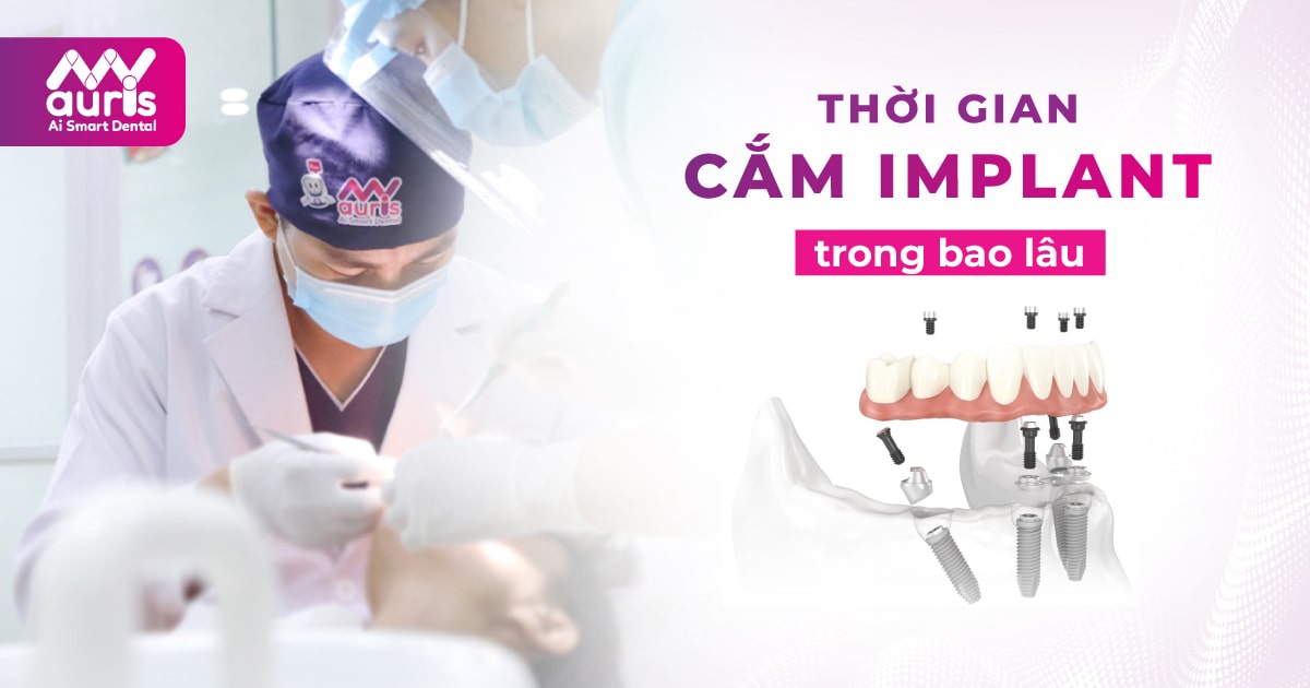 thời gian cắm implant