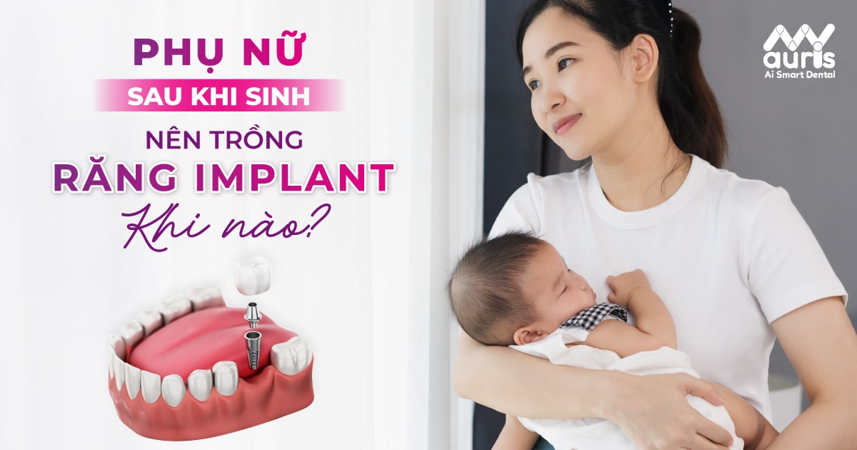 sau sinh bao lâu thì trồng răng được