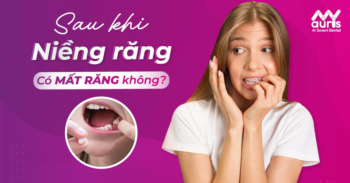 niềng răng có bị rụng răng không