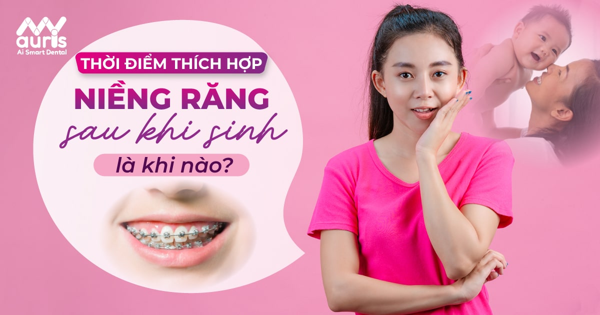 sau sinh bao lâu thì niềng răng được