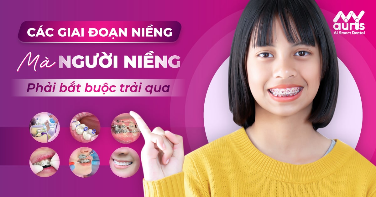 niềng răng mắc cài có đau không