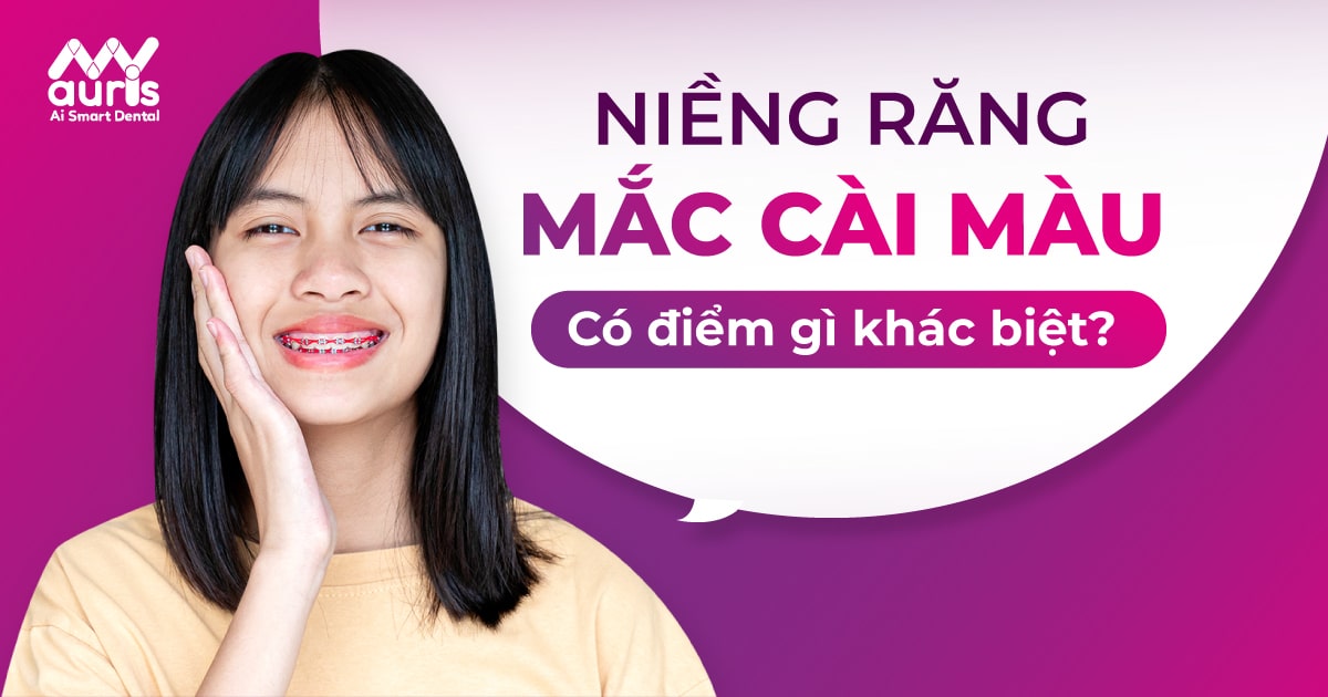 Có thể tùy chọn màu sắc niềng răng phụ thuộc vào sở thích cá nhân không?
