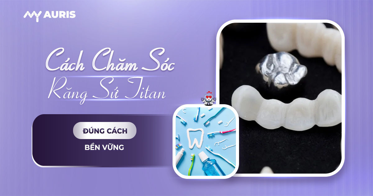 cách bảo quản răng sứ titan