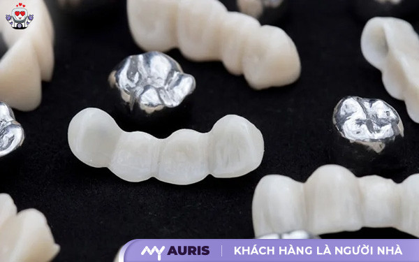 cách bảo quản răng sứ titan