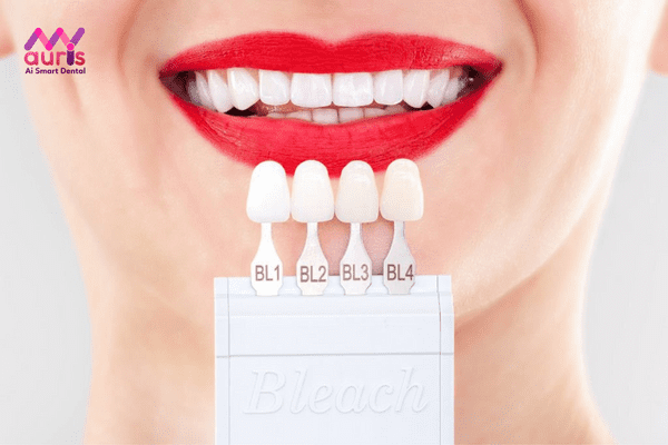 Răng sứ kim loại Mỹ có tốt không? Giải đáp qua những ưu điểm
