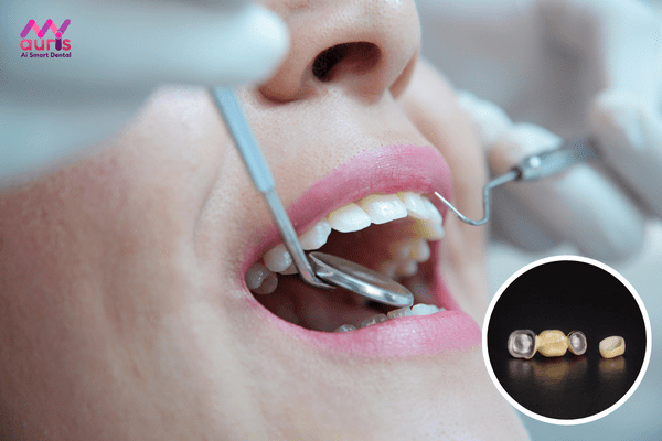  răng sứ titan có làm đen viền nướu