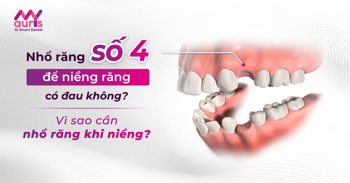 Có bất kỳ lưu ý gì khi chăm sóc miệng sau khi nhổ răng số 4? 
